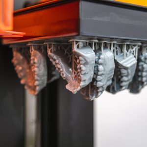 Jaw,Models,Being,Printed,In,Resin,On,A,3d,Printer